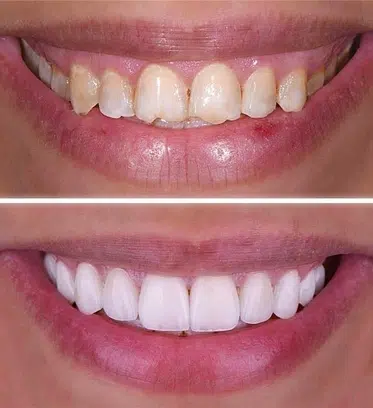 Dental