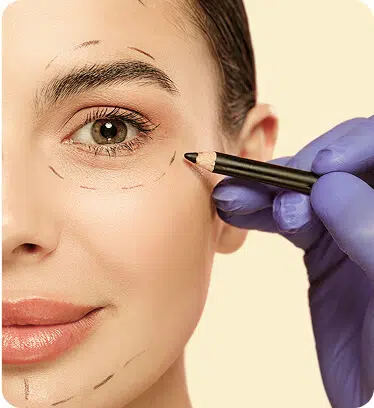 Plastic surgery